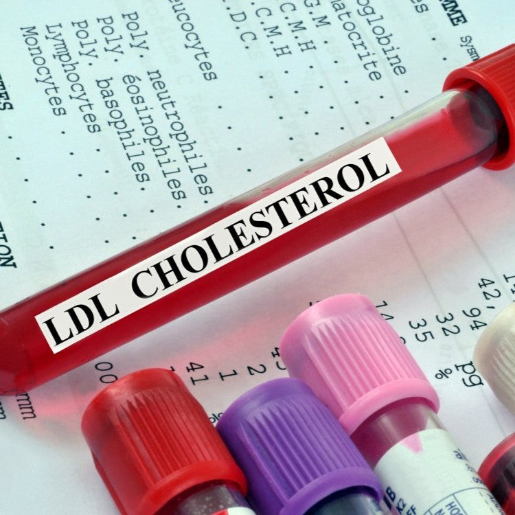 test tube labelled LDL cholesterol
