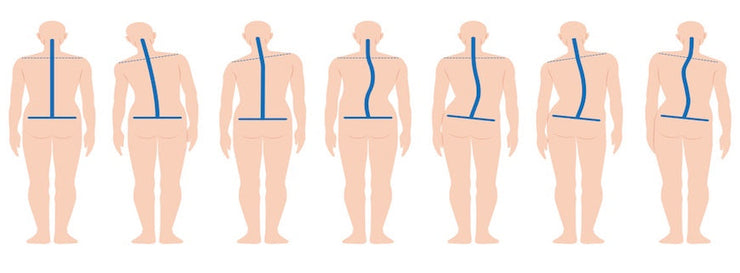 seven drawings of human beings with different shapes spines highlighted in blue
