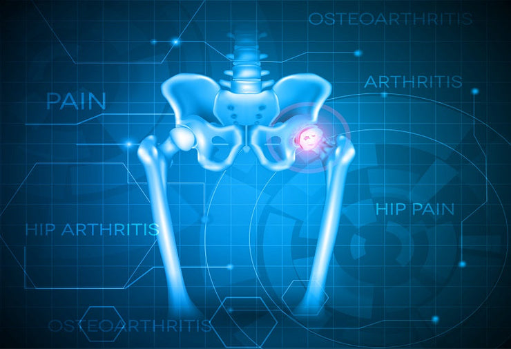 Stronger Bones Naturally