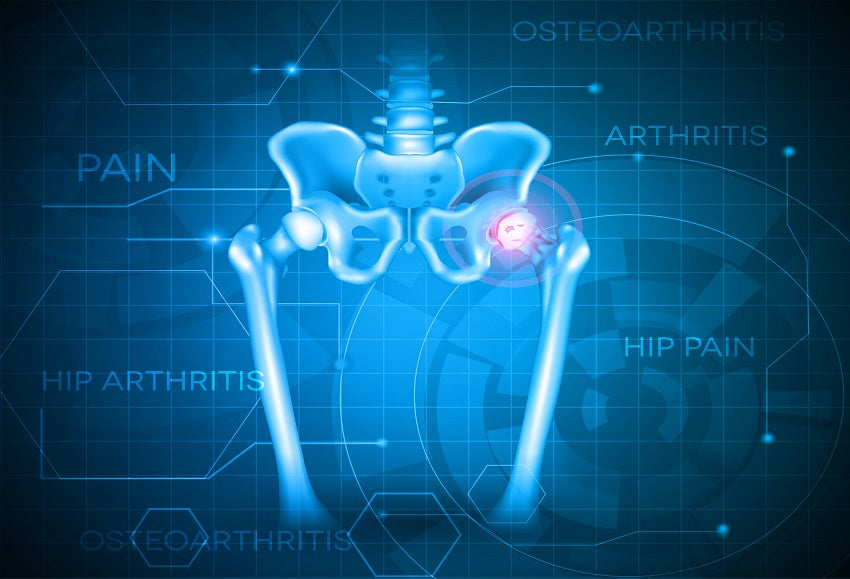 Stronger Bones Naturally