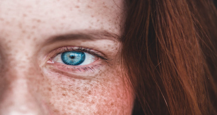 Natural Ways to treat dry, itchy, red eyes