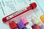 blood test tube LDL cholesterol