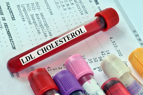 blood test tube LDL cholesterol